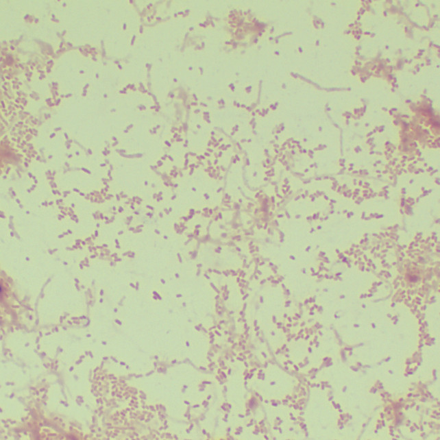 Salmonella schwarzengrund II-BNCC