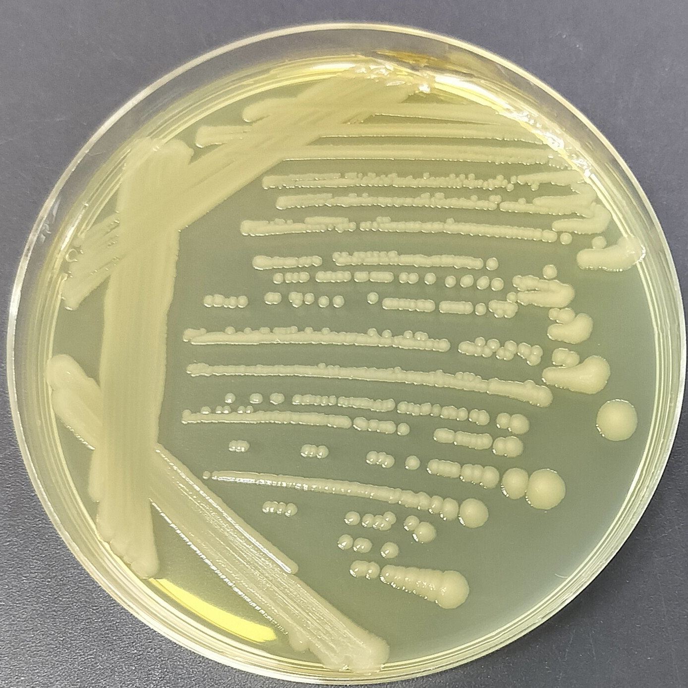 Rat typhoid fever R-BNCC