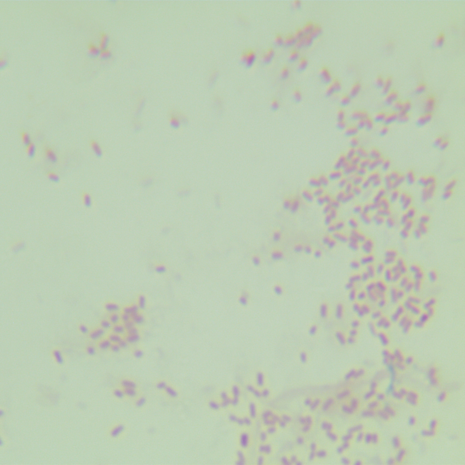Rat typhoid fever R-BNCC