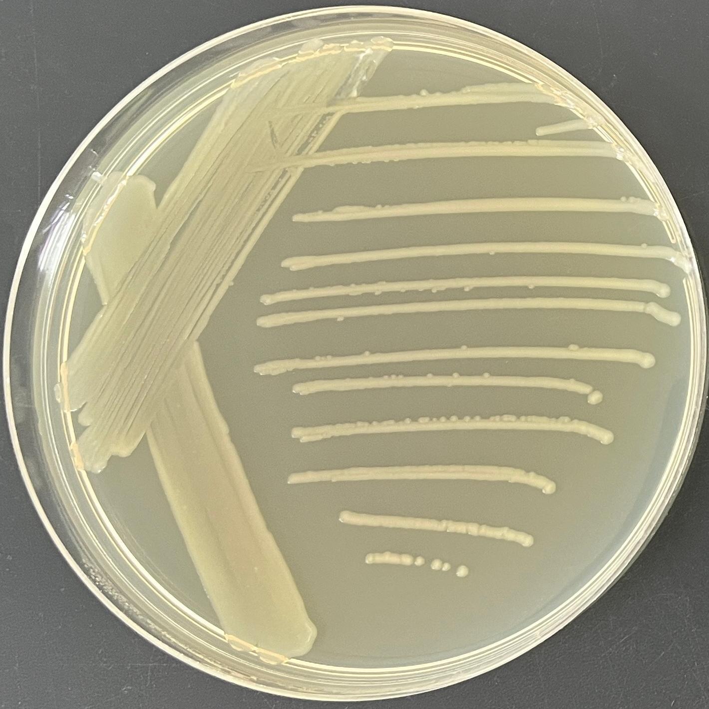 Rat typhoid fever H2S --BNCC