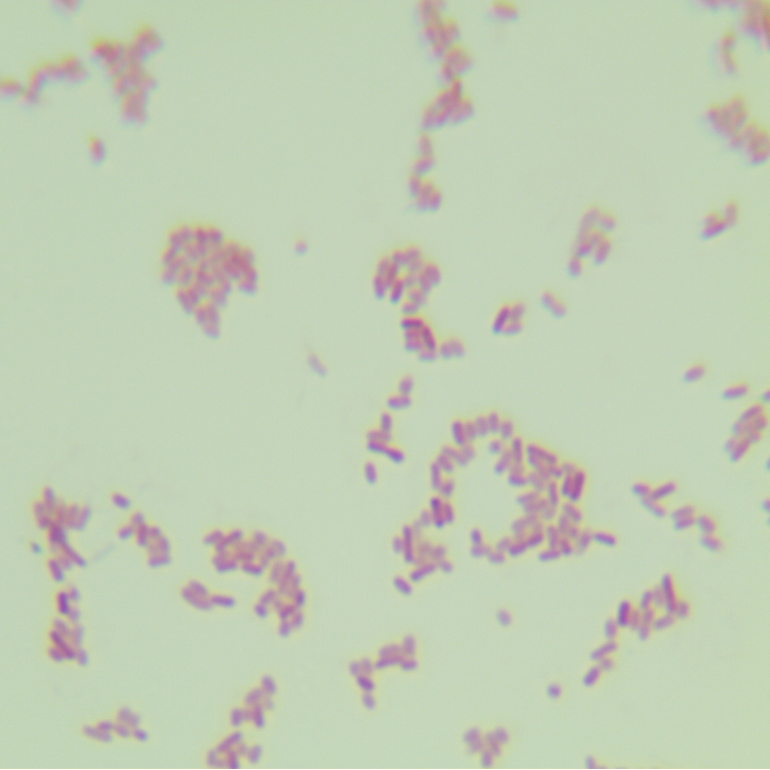 Rat typhoid fever H2S --BNCC