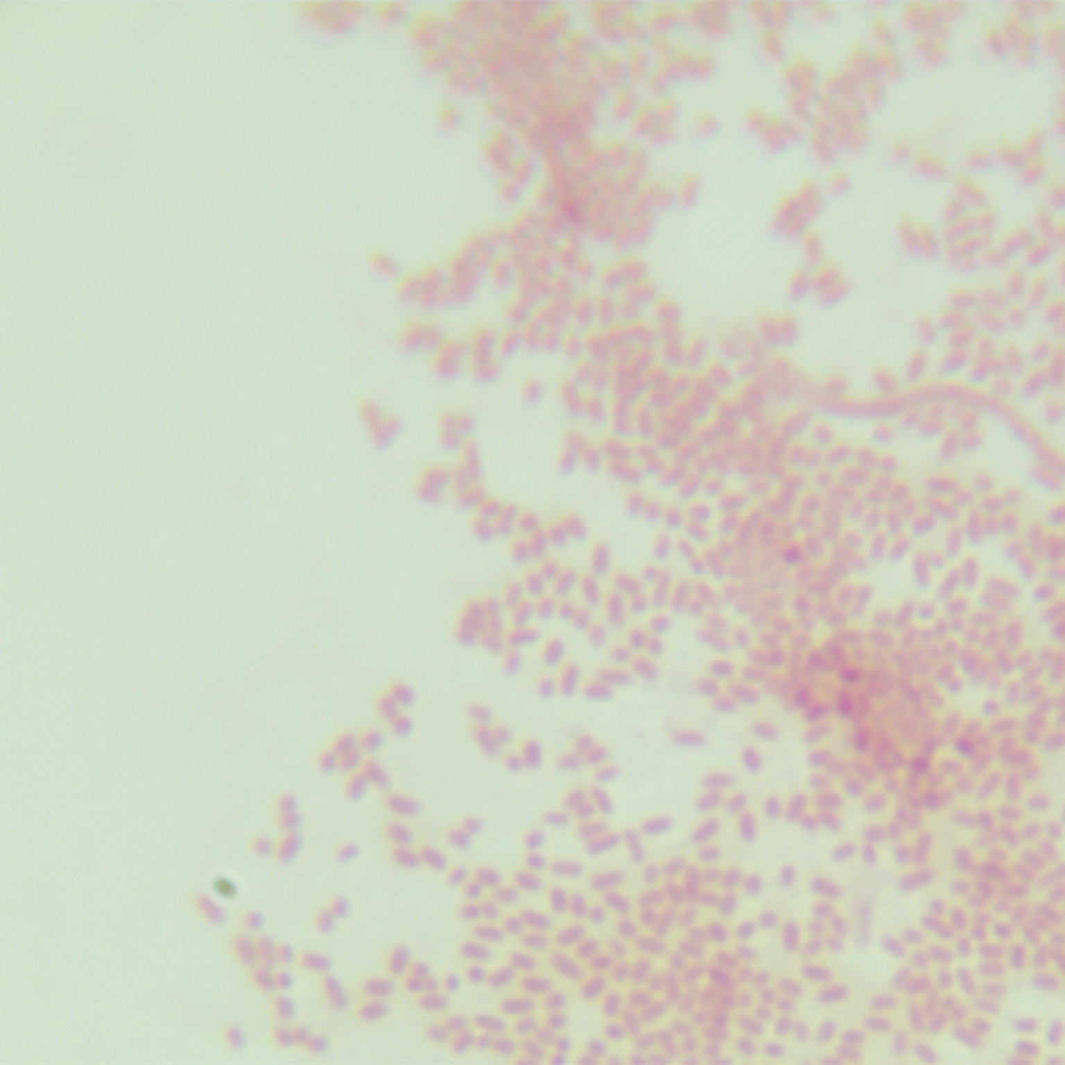Rat typhoid fever H2S --BNCC