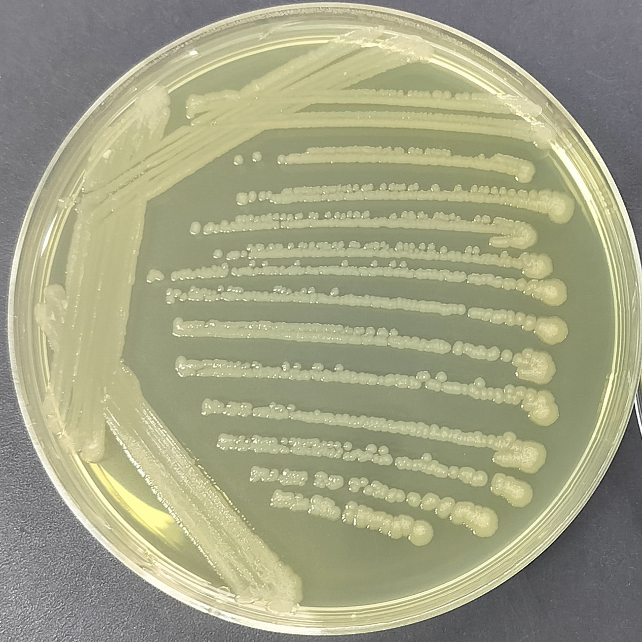 Rat typhoid fever H2S --BNCC