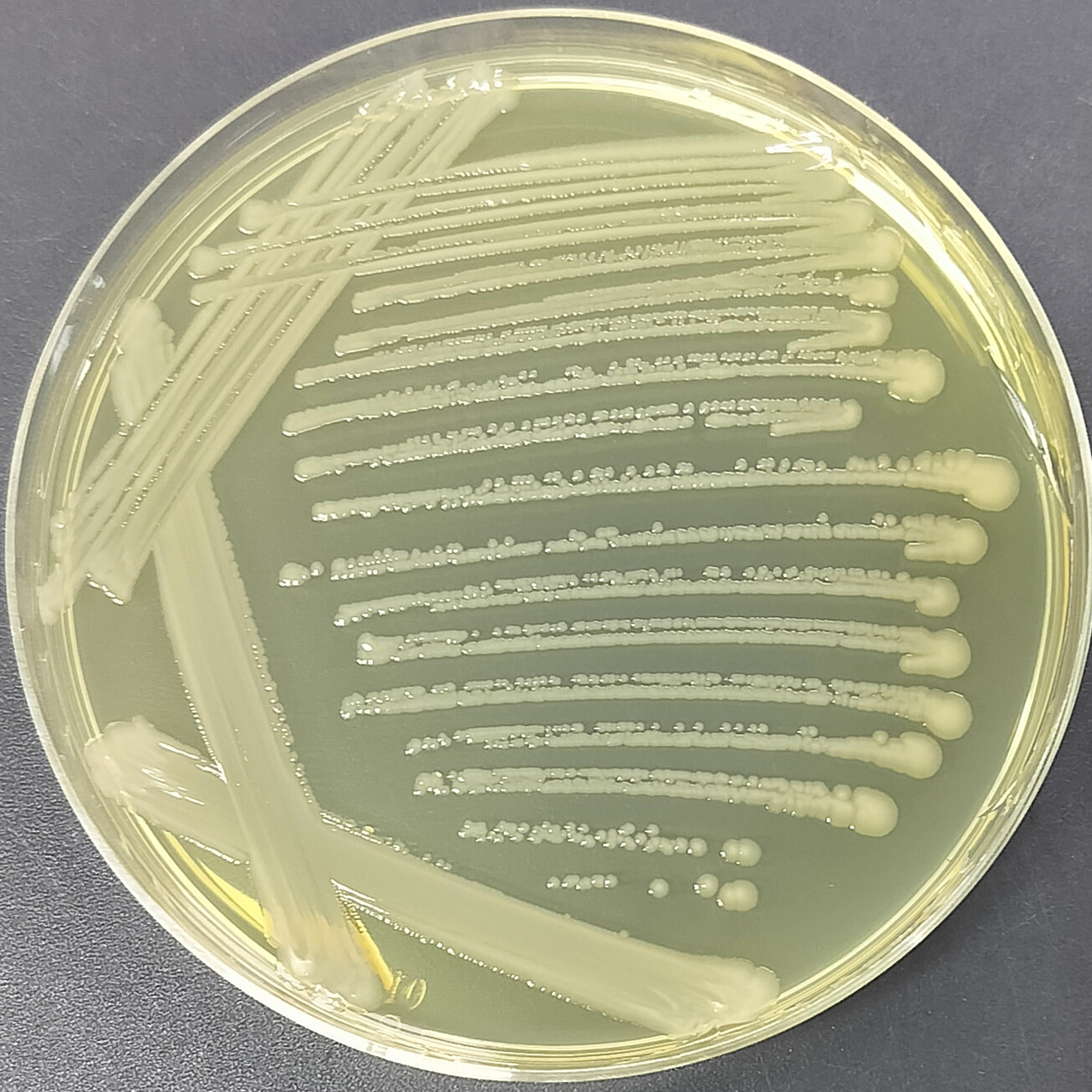 Rat typhoid fever R, H2--BNCC