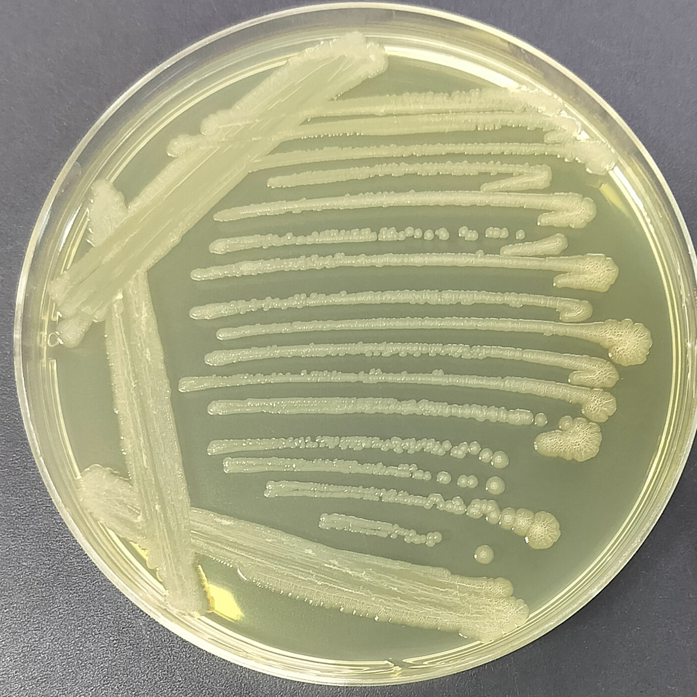 Rat typhoid fever R, H2--BNCC