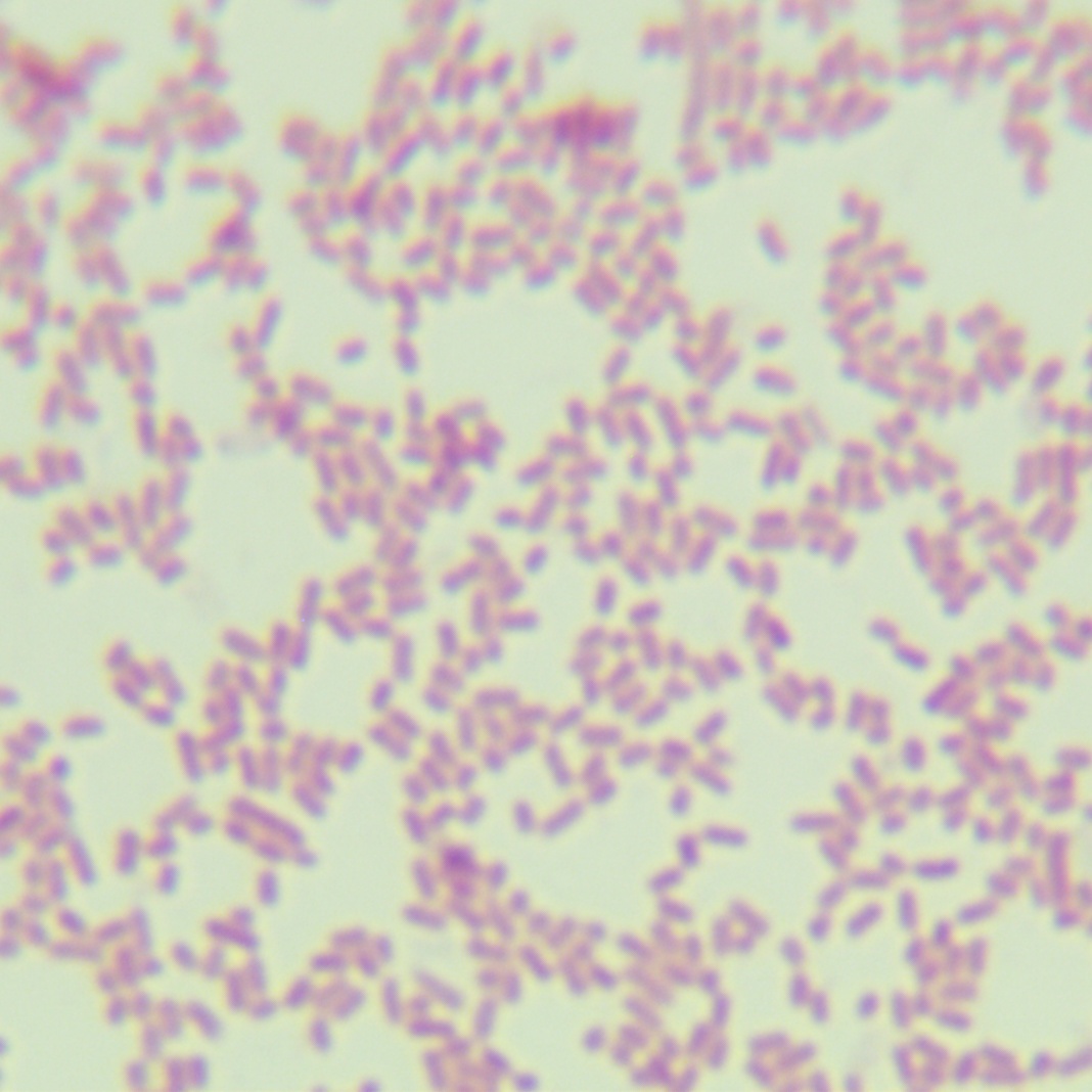 Salmonella senfenberg-BNCC