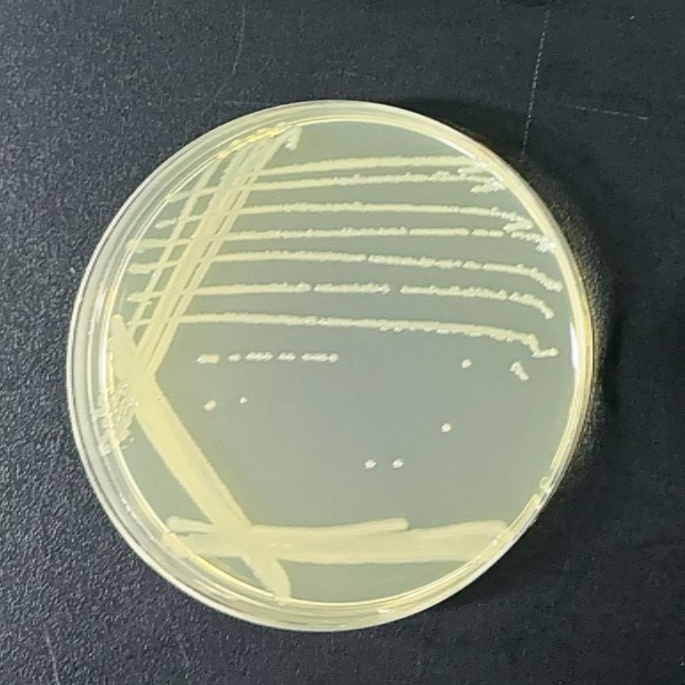 Salmonella enterica serovar Orangeburg-BNCC