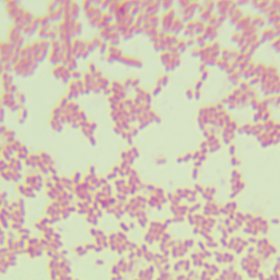 Salmonella enterica serovar Orangeburg-BNCC