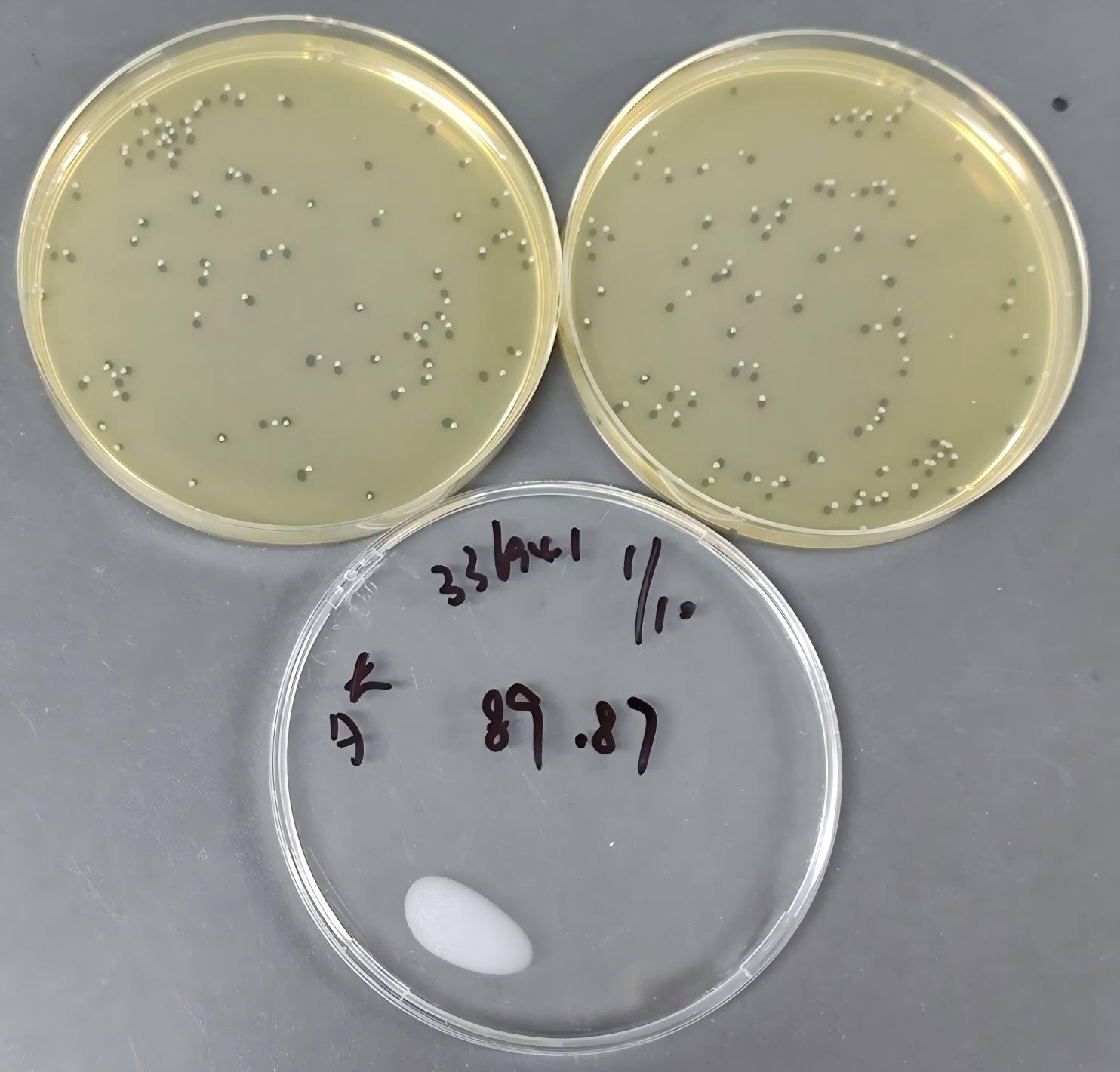 Quantitative strain of Nocardia enterica-BNCC