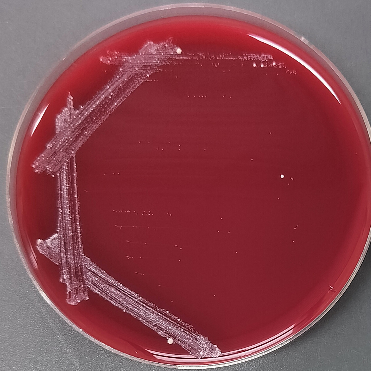 Epidermal rod-shaped bacteria-BNCC
