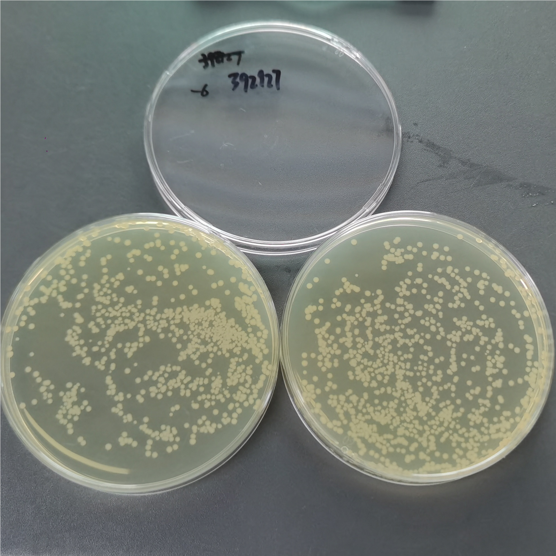 Escherichia coli-BNCC