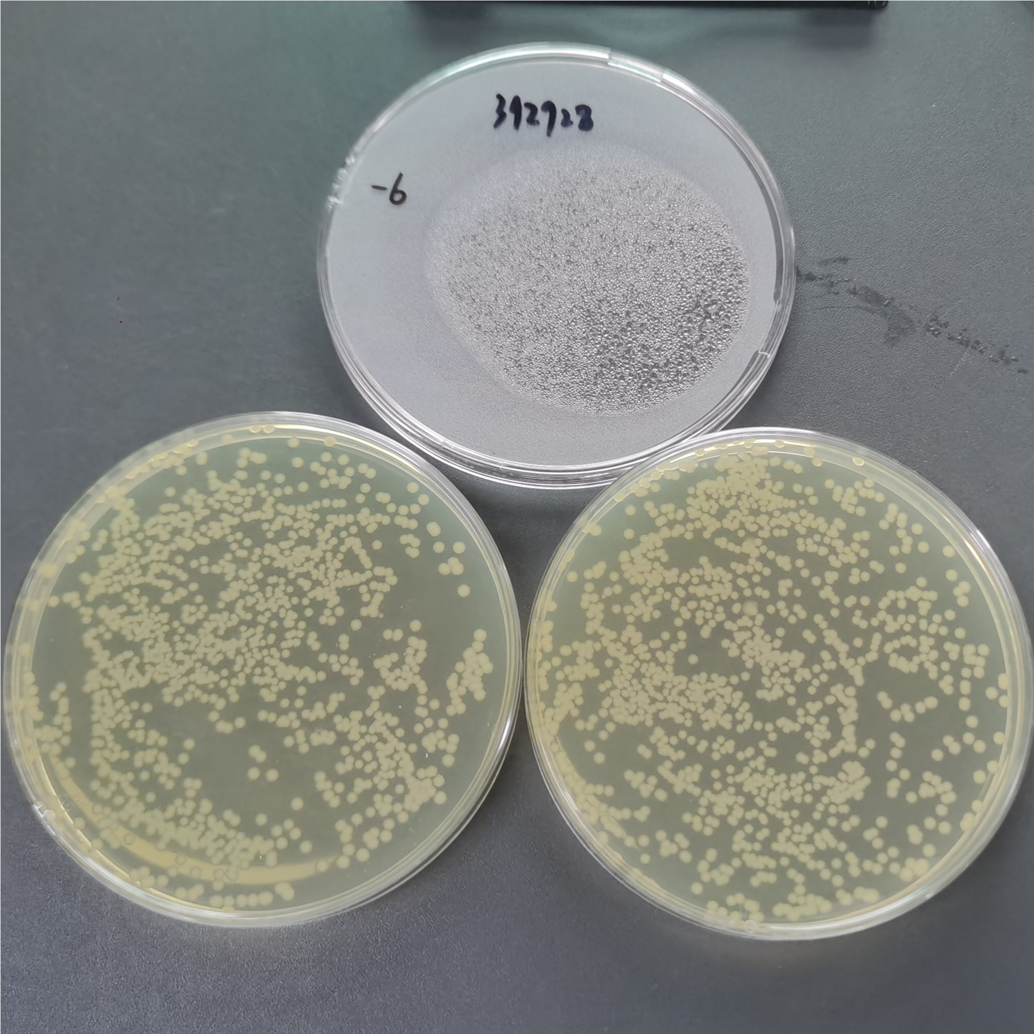 Escherichia coli-BNCC