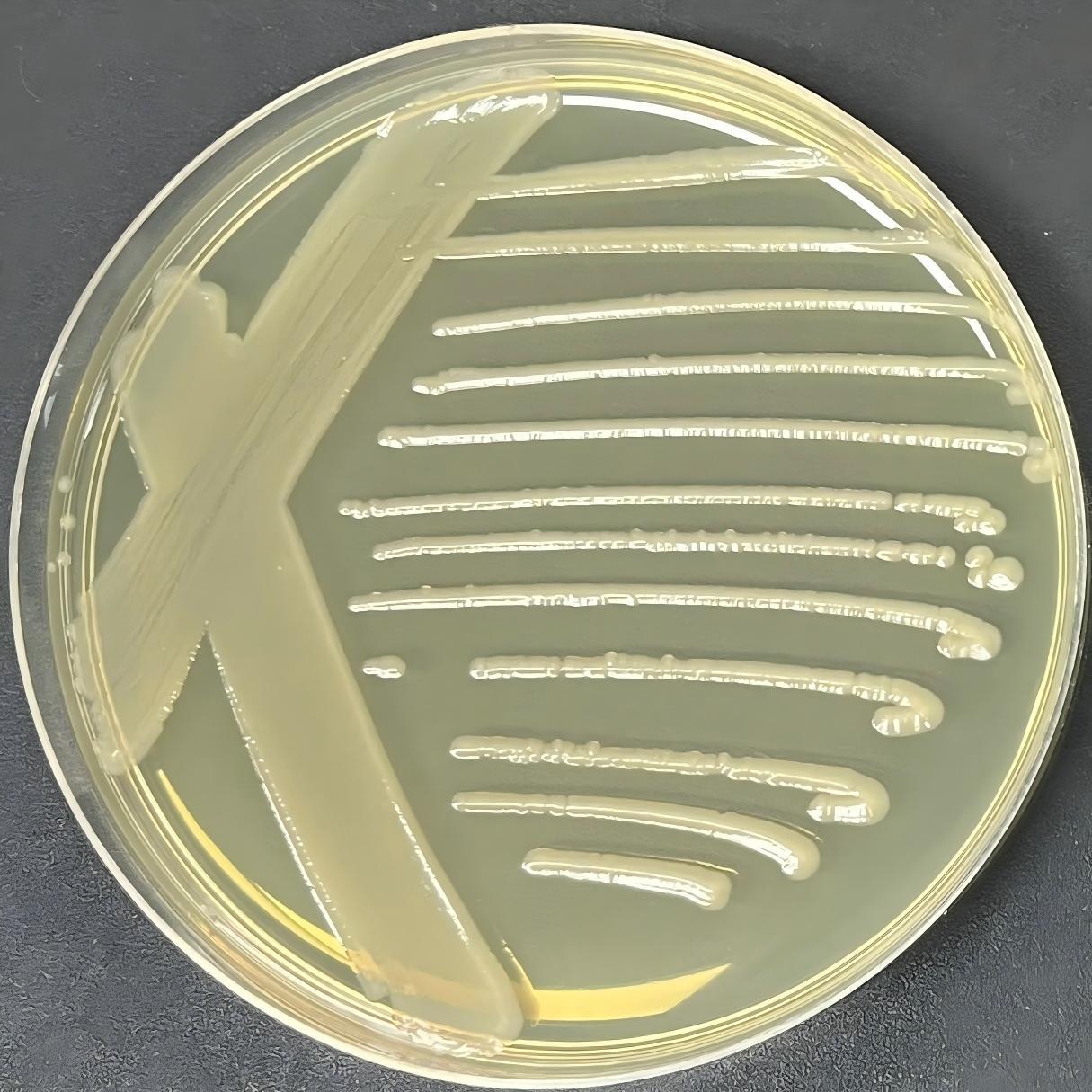 Escherichia coli-BNCC