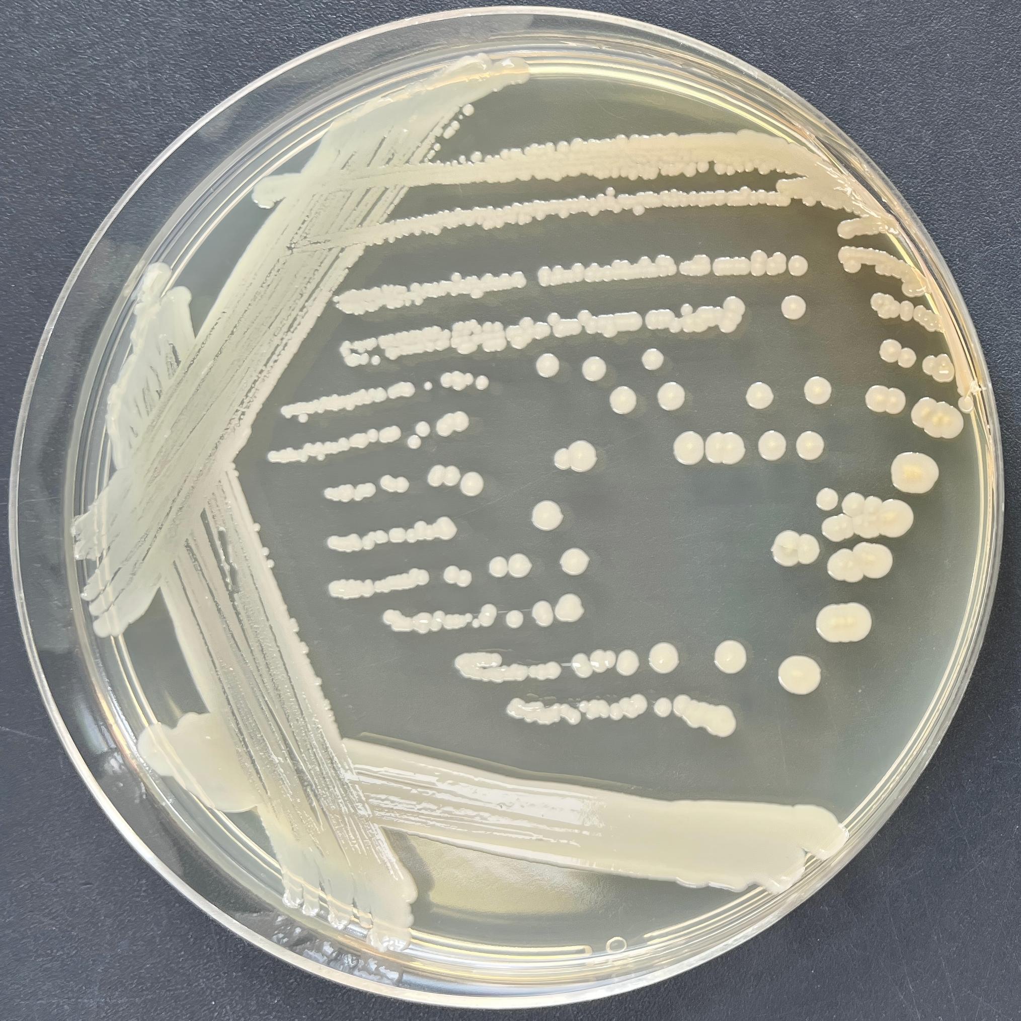 Staphylococcus aureus subspecies HUSA304-BNCC