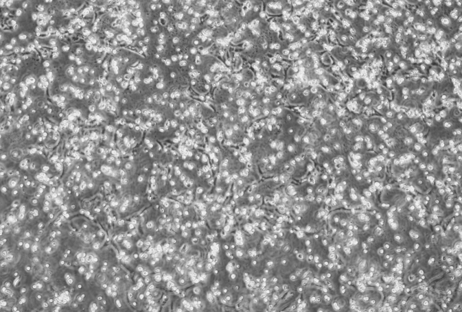 Novel Coronavirus Japanese Strain-BNCC