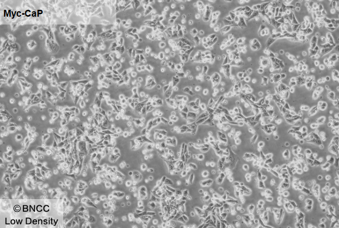 Mouse prostate cancer cells-BNCC