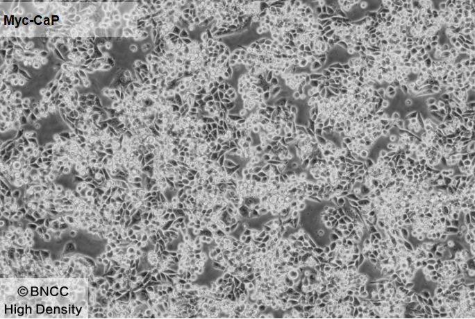 Mouse prostate cancer cells-BNCC