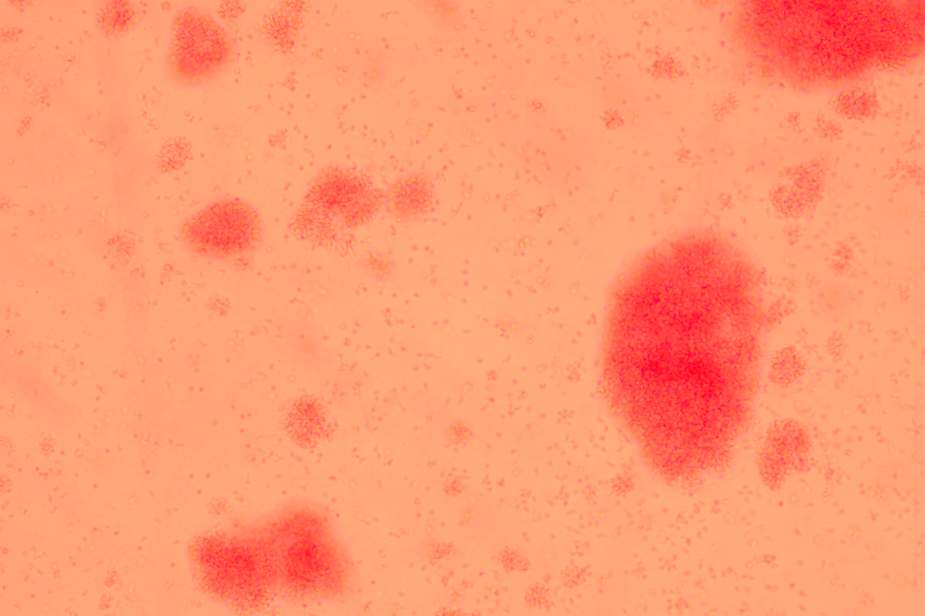 [Autologous cell immunotherapy] Cytokine induced killer cells (CIK)-BNCC