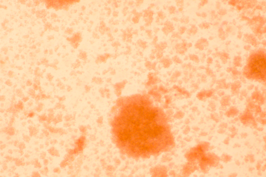 [Autologous cell immunotherapy] Cytokine induced killer cells (CIK)-BNCC