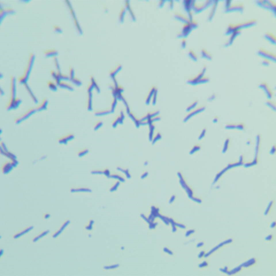 Nocardia in yellow catfish-BNCC