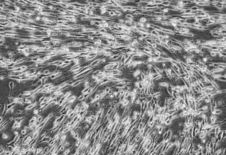 Human Cytomegalovirus (U140 gene) inactivated virus nucleic acid standard substance-BNCC