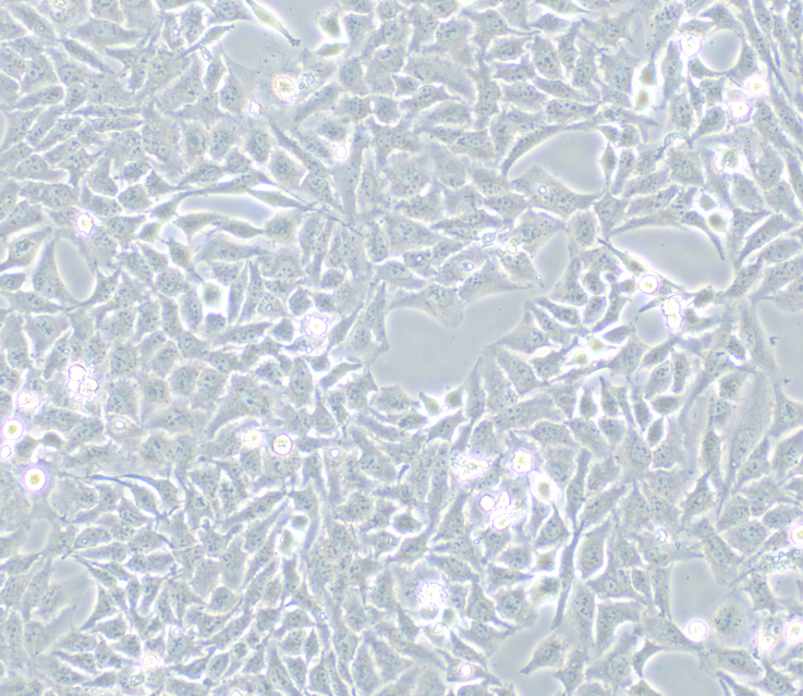 Human adenovirus type 5 (Hexon gene) inactivated virus nucleic acid standard substance-BNCC