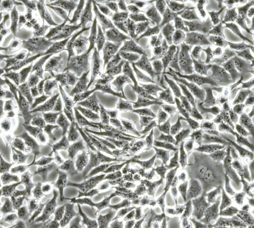 Human adenovirus type 40 (Hexon gene) inactivated virus nucleic acid standard substance-BNCC