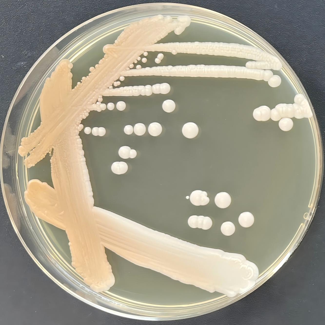 Depali yeast-BNCC