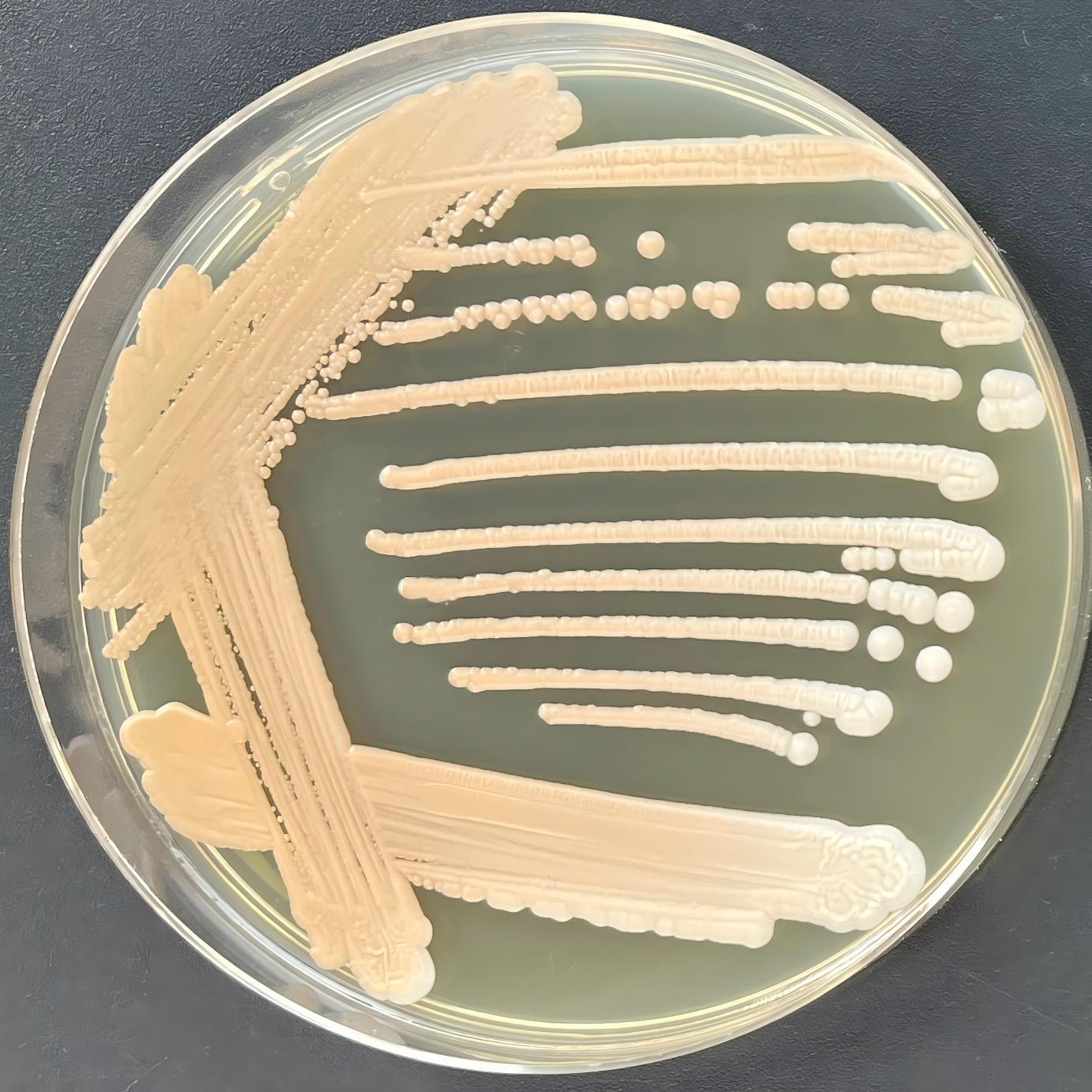 Depali yeast-BNCC