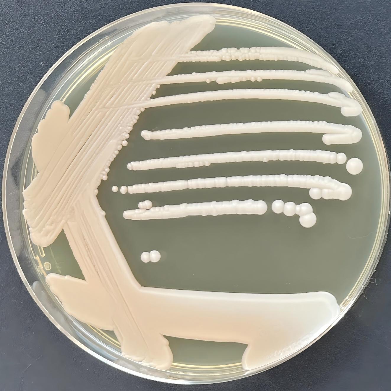 Depali yeast-BNCC