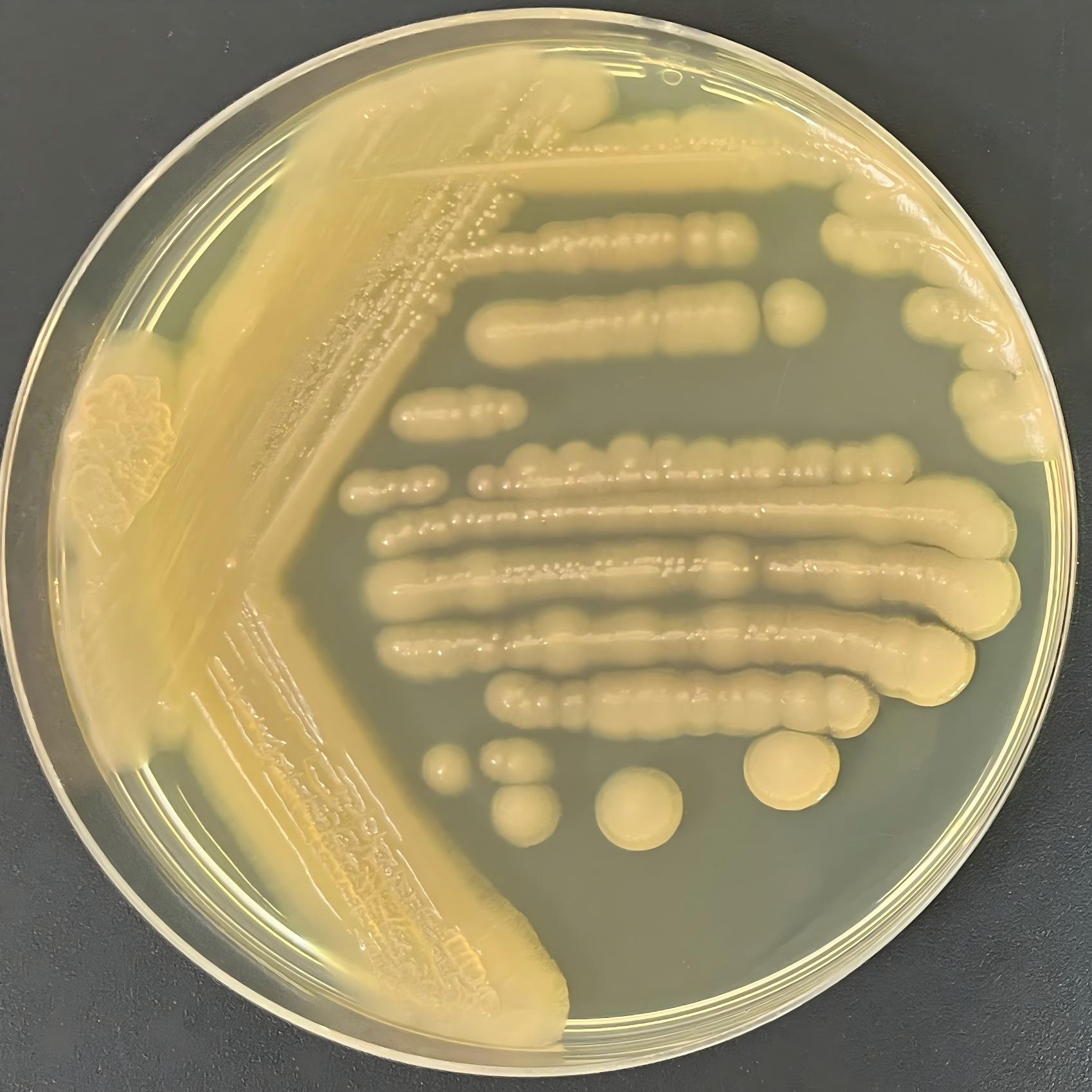 Short stem fungi-BNCC