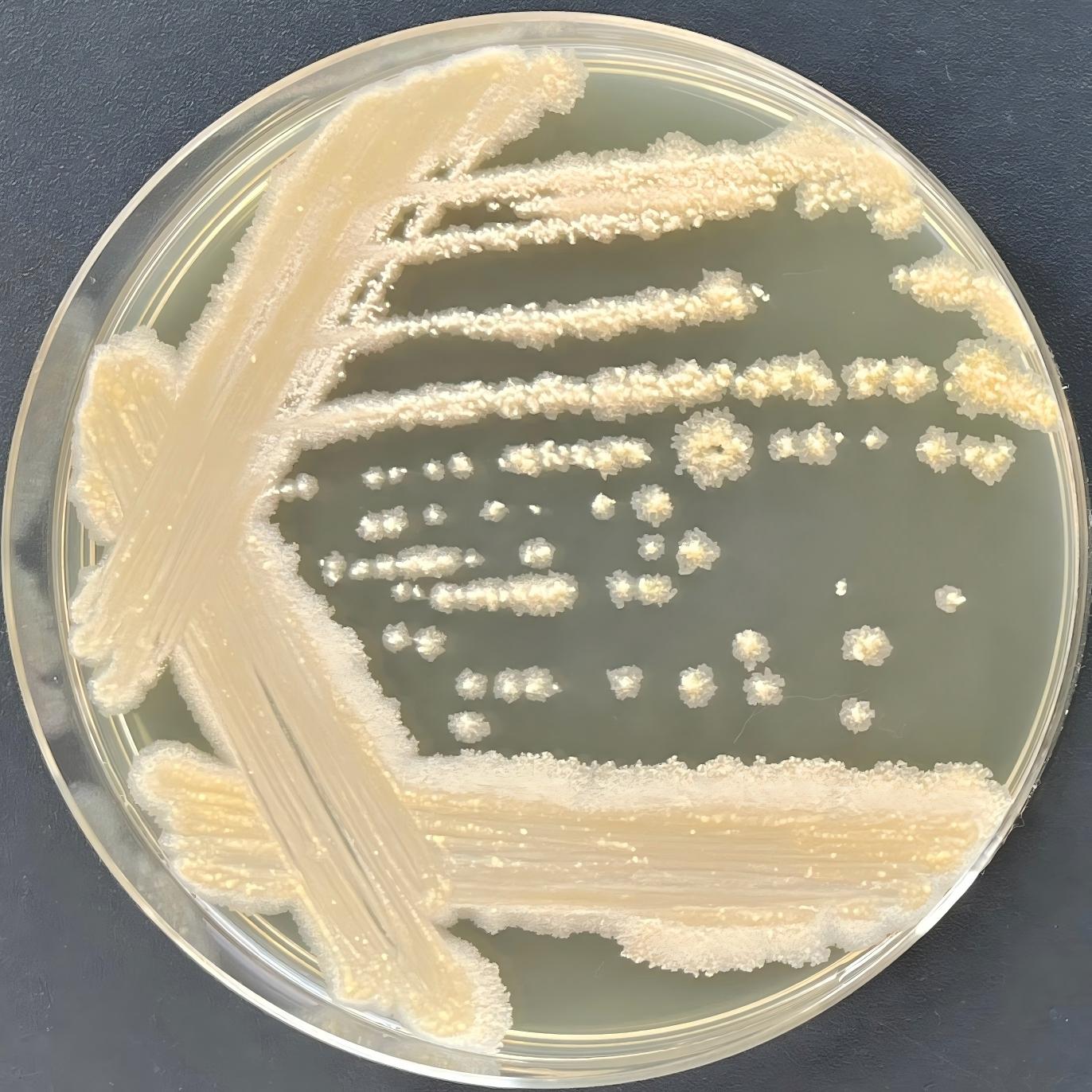 Zumura fungus-BNCC