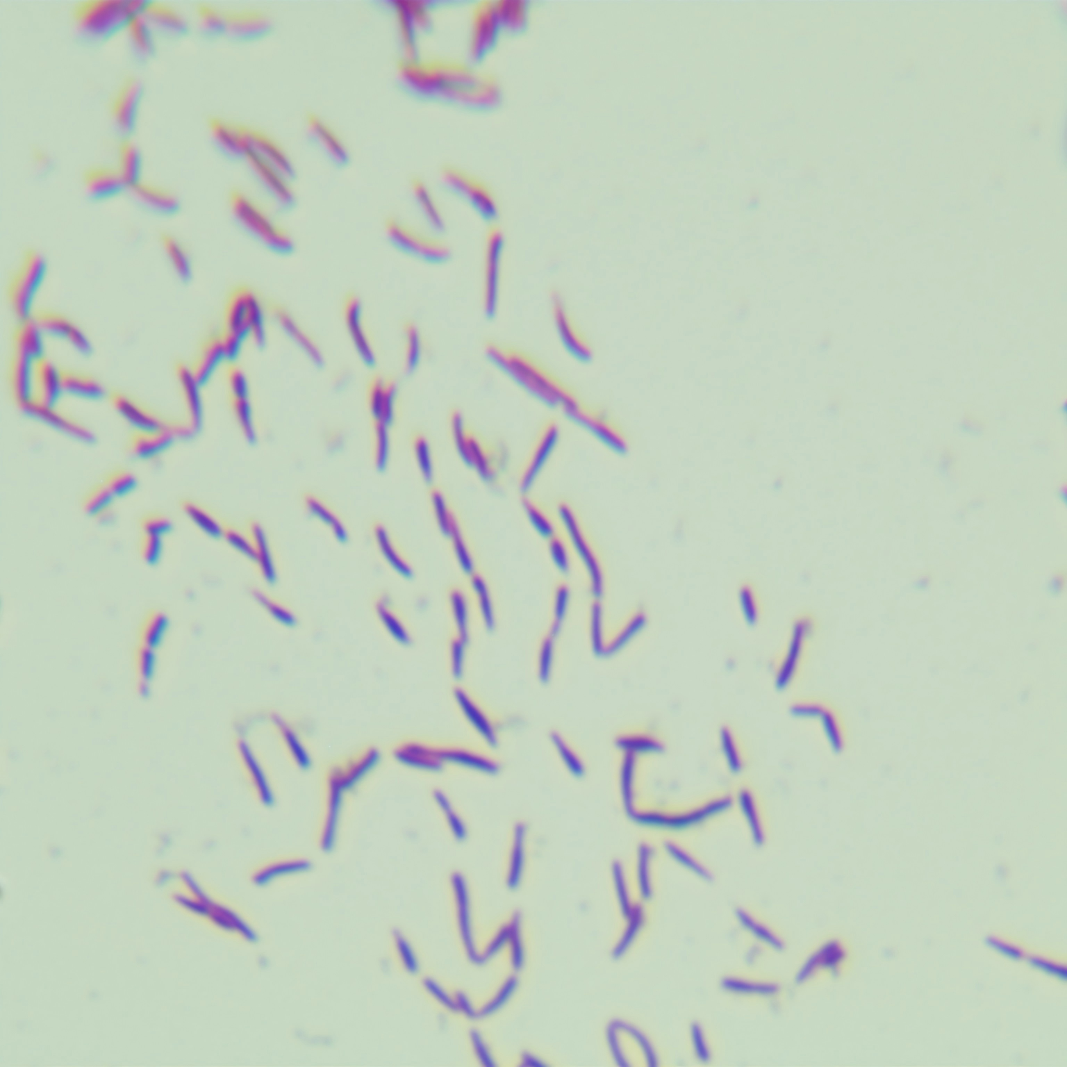 Zumura fungus-BNCC