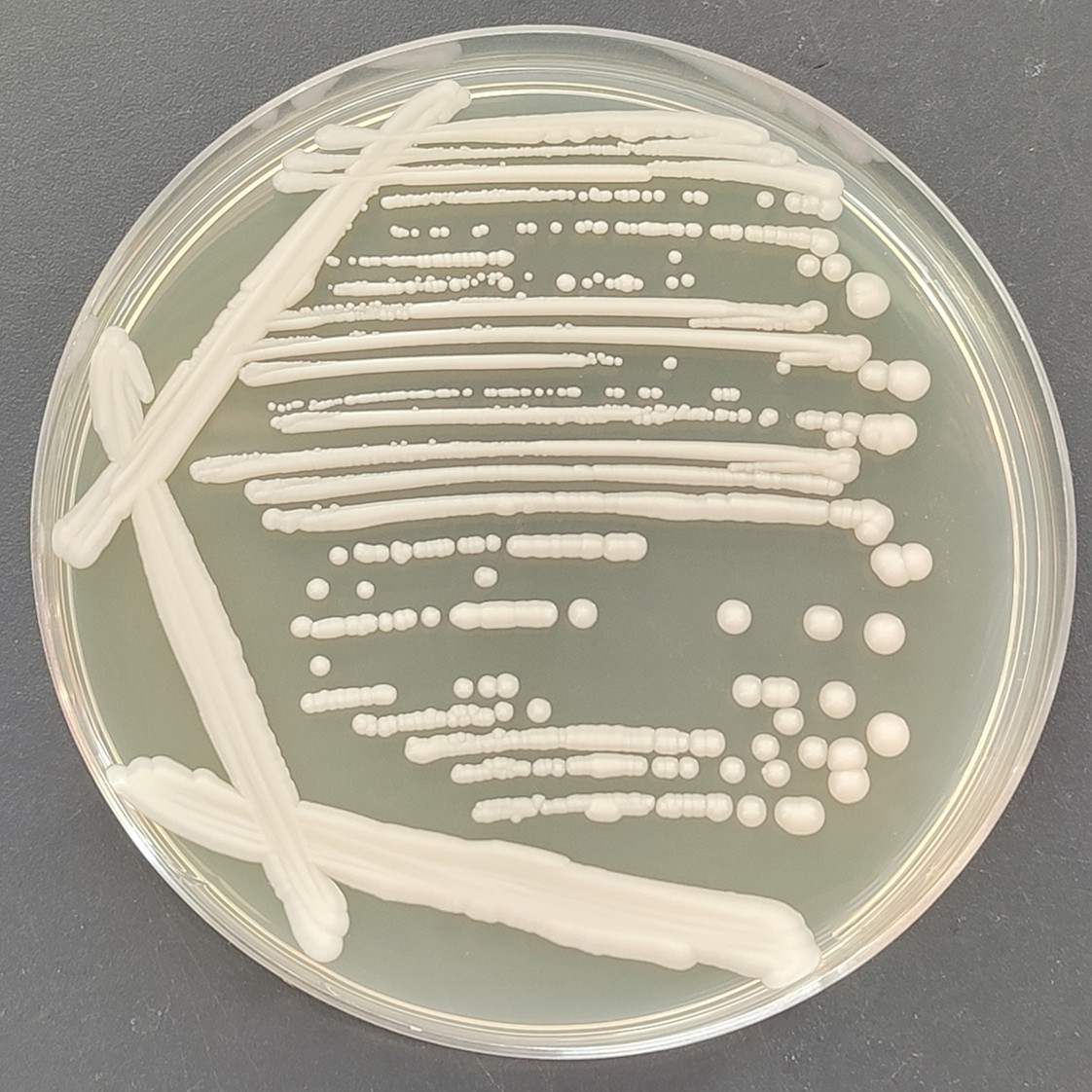 Saccharomyces cerevisiae-BNCC