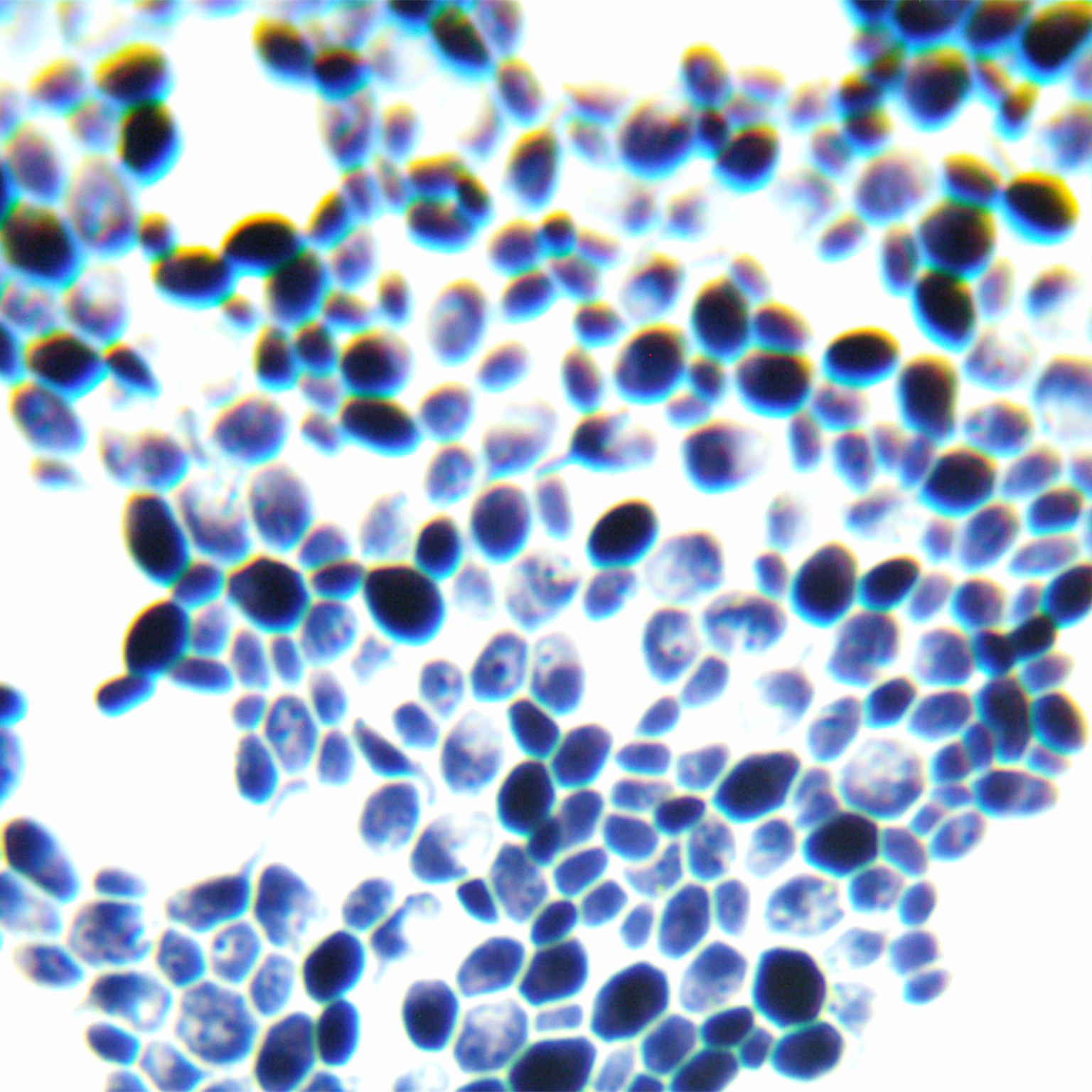 Saccharomyces cerevisiae-BNCC