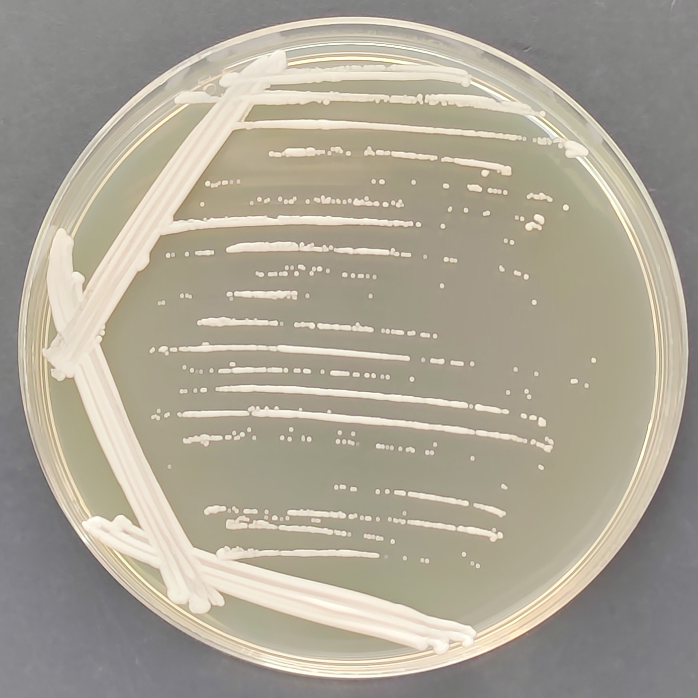 Depali yeast-BNCC