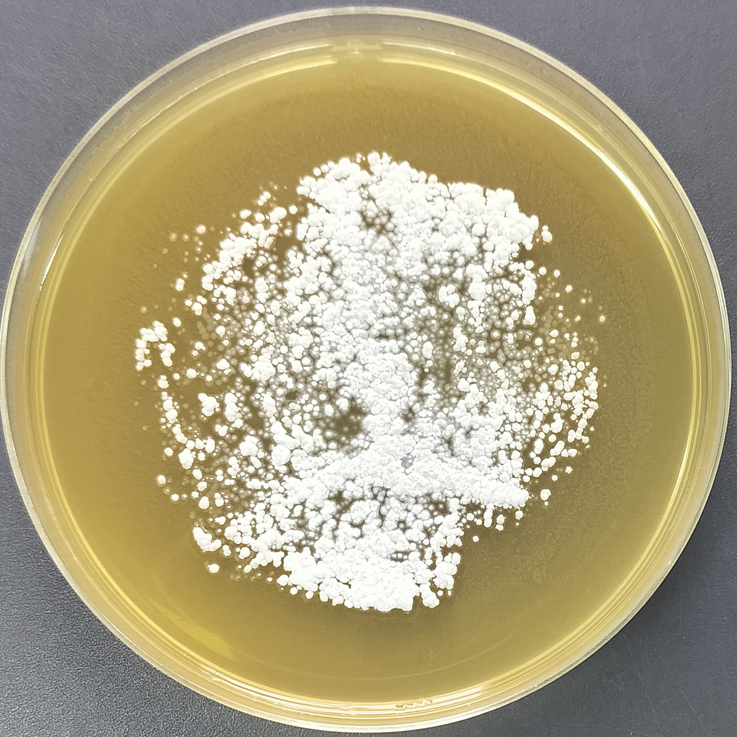 Soft haired Streptomyces-BNCC
