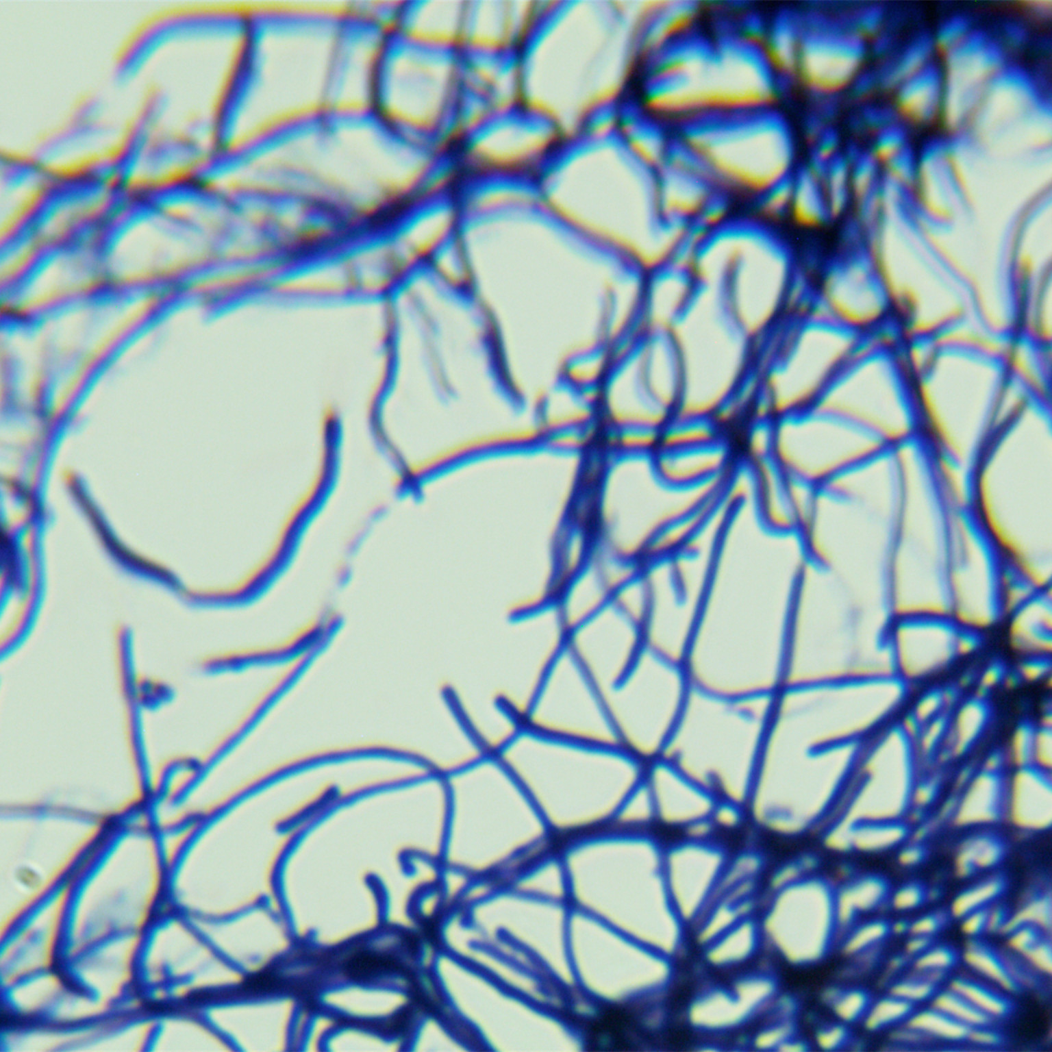 Soft haired Streptomyces-BNCC