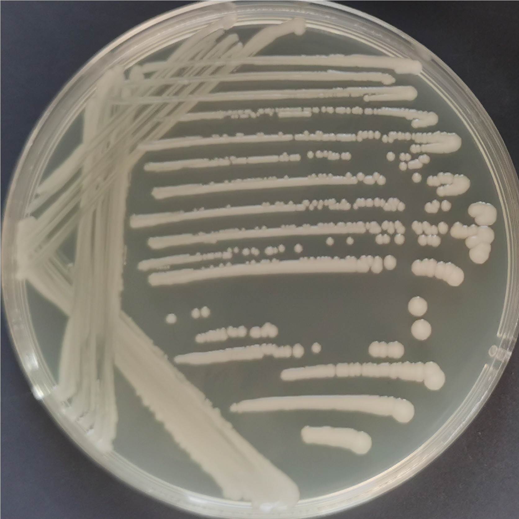 Radiation resistant Acinetobacter-BNCC