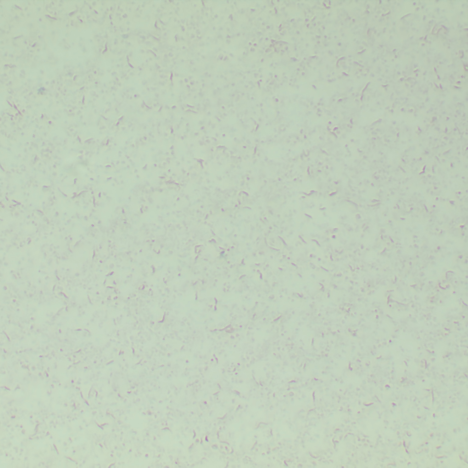 Curvibacter marinus-BNCC