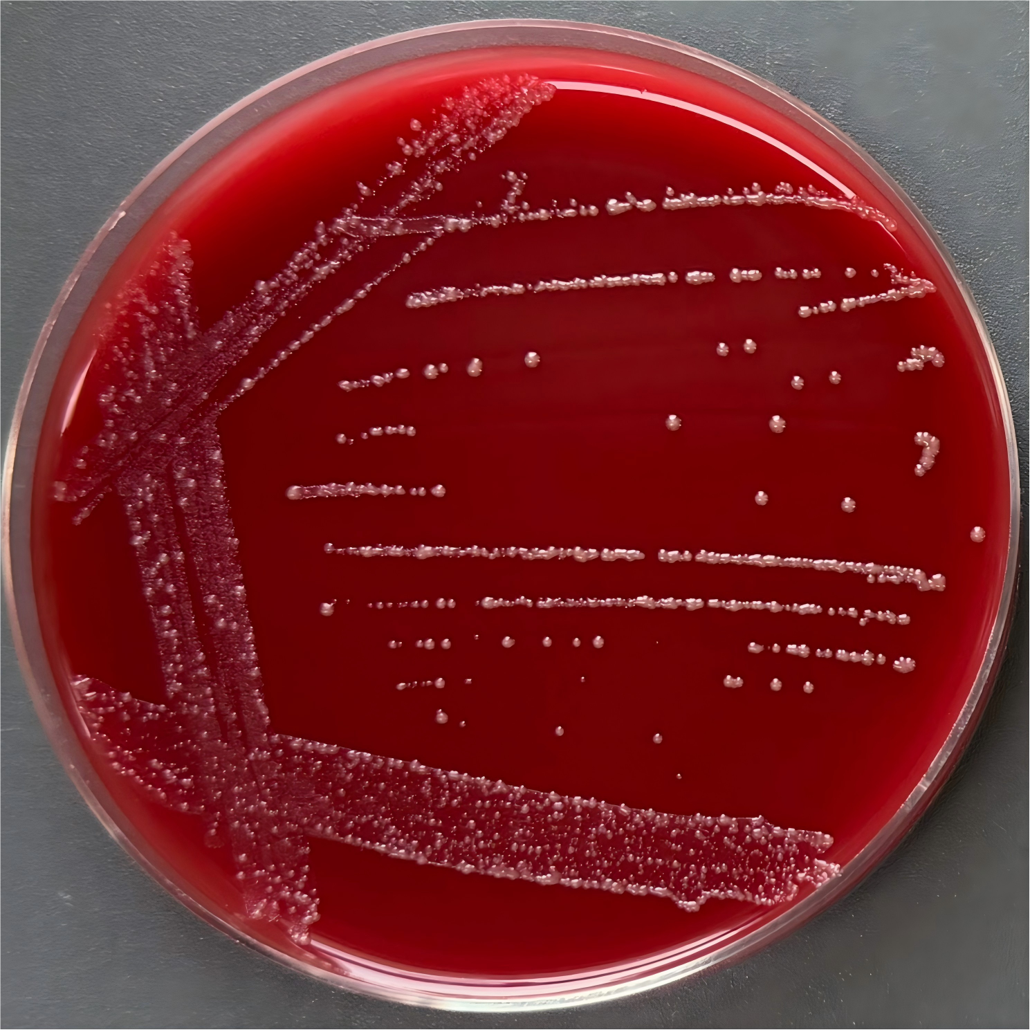 Curvibacter marinus-BNCC